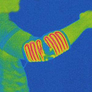 Venture Heat thermal imaging showing heat distribution on an arm